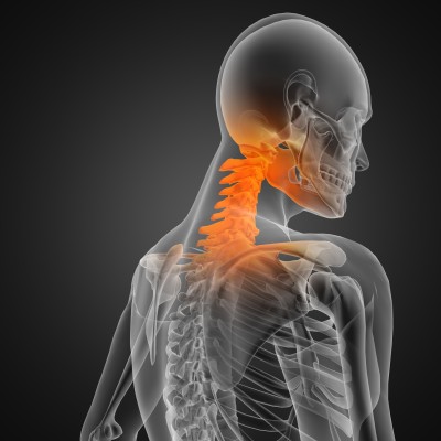 Facet Joint and Neck Injuries From Car Accidents