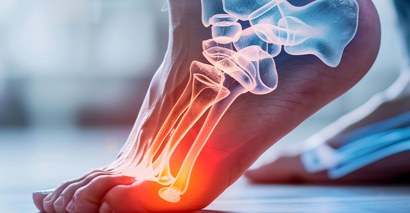 ligament Ligament and Muscle injuries