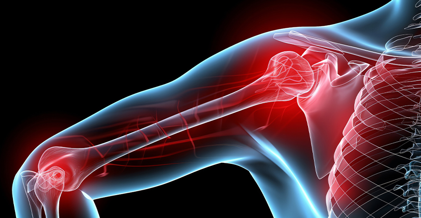 Shoulder injuries in MA