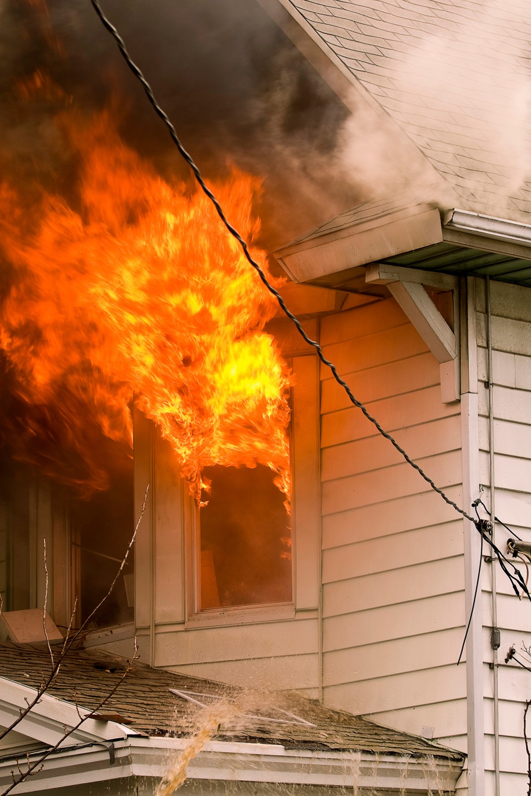 AdobeStock_262644836 burn injury lawyers